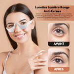 Lunettes Lumière Rouge Anti-Cernes